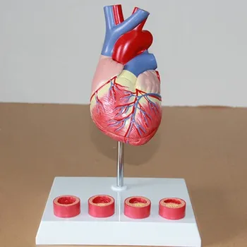 1:1 Анатомическая модель человеческого сердца, медицинская обучающая модель тромба, бесплатная доставка