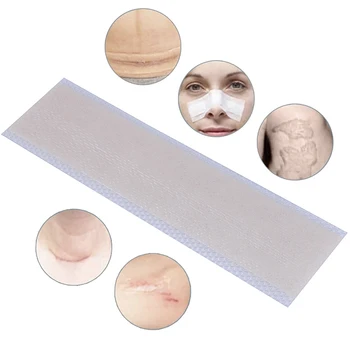Пластырь для лечения шрамов для восстановления кожи Силиконовый пластырь для удаления шрамов Удаляет травму, Ожог, шрам Для лечения шрамов от угревой сыпи